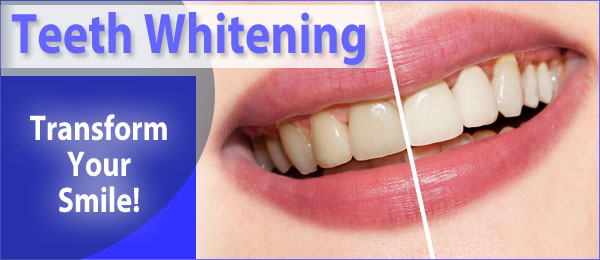 Teeth whitening advert